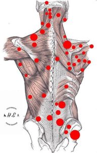 malatyaeniyifizyoterapist,fibromiyaljitedavisi