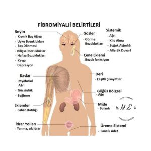 malatyaevdefiziktedavi,fibromiyalj,