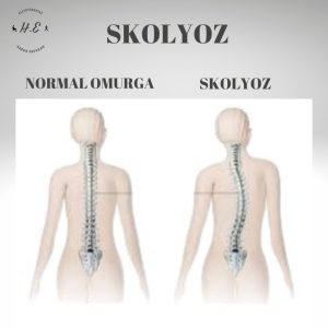 malatyaevdefiziktedavi